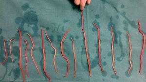 Kisah Tragis Raya: Kenali Penyebab Cacingan Pada Anak | empower